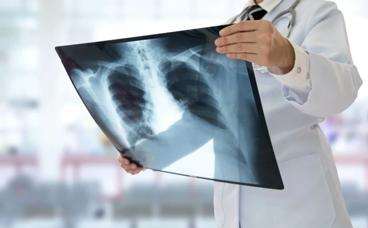 Plămânii tăi pot fi curățați rapid dacă folosești aceste PLANTE medicinale precum…